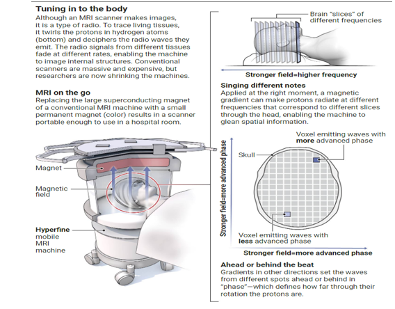 MRI.177